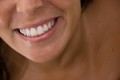Implantate: Zahnersatz mit hoher Funktionsfähigkeit