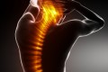 Spinalkanalstenose: Nicht immer ist eine OP nötig